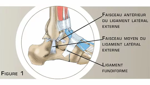 Ligamentoplastie de cheville